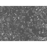 Patient Derived Gastric Tumor Cells