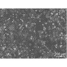 Patient Derived Gastric Tumor Cells