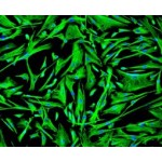 Human Hepatic Stellate Cells (Normal and NASH)
