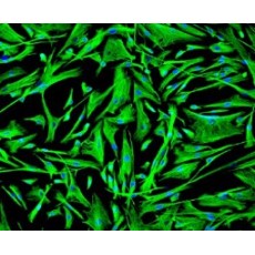 Human Hepatic Stellate Cells (Normal and NASH)