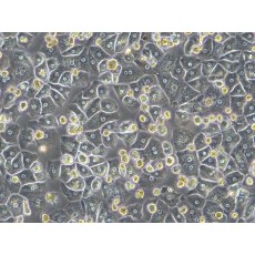 Primary Human Hepatocytes (PHH), Plateable