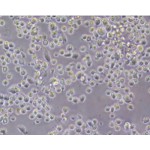 Human Non-Parenchymal Cells (NPC)