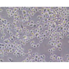 Human Non-Parenchymal Cells (NPC)