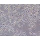 Human Non-Parenchymal Cells (NPC)