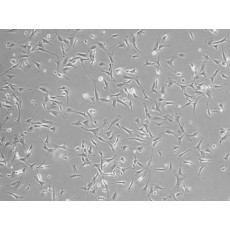 Human Dermal Fibroblasts