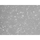 Human Dermal Fibroblasts