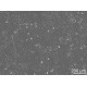 Human Epidermal Keratinocytes, neonatal (HEKn)