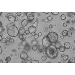 Human Gastric Cancer Organoid