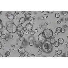 Human Gastric Cancer Organoid